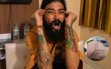 Anurag Dobhal Reveals Stitched Wounds After Accident, Calls It “Zindagi Ki Nayi Shuruaat” Amid Ongoing Controversy 