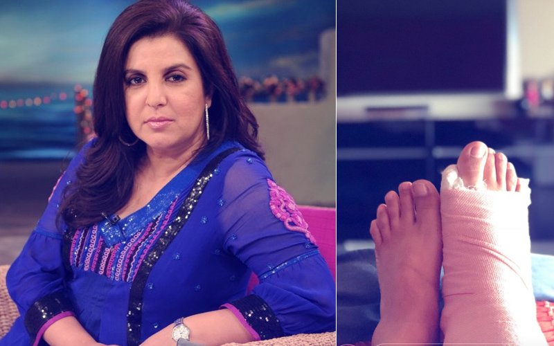 OH NO! सोनम कपूर के संगीत के 6 दिन पहले फ्रैक्चर हुआ कोरियोग्राफर फराह खान का पैर