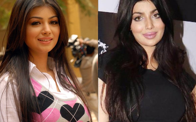 Ayesha Takia Slams Trollers Ridiculing Her For Going Under The Knife
