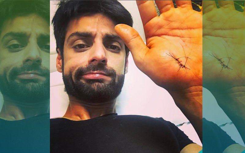 OUCH! TV Heartthrob Karan Wahi Injures His Hand, Gets Stitches