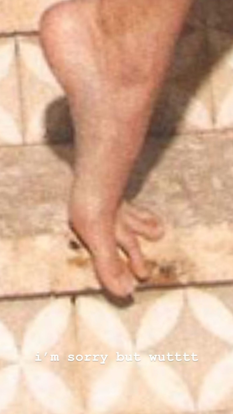 kendalls weird foot2