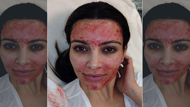Kim Kardashian Sues Charles Runels For Using Her Picture Without Permission To Promote Vampire Facial