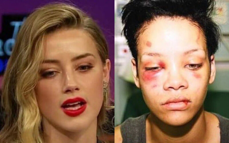 Rihanna’s ‘Beaten Up’ Pic Compared To Amber Heard’s By Johnny Depp Fans As They Say, 'This Is What Real Abuse Looks Like'