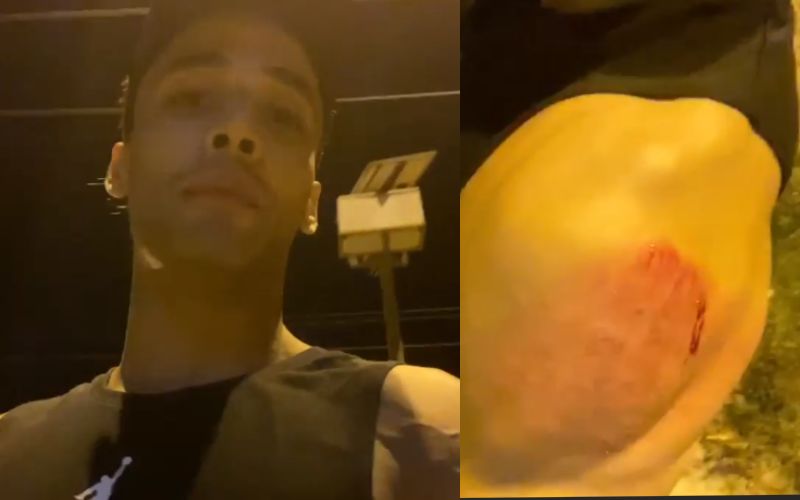 Asim Riaz Brutally ATTACKED While He Was Out Cycling; Bigg Boss 13 Star Shares Pics And Videos Of Savage Multiple Bruises