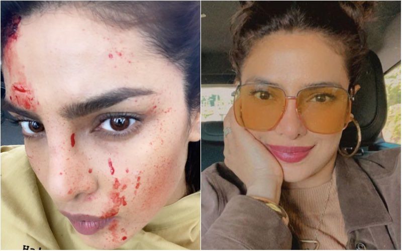 Priyanka Chopra Jonas Drops A Bloody-Faced Selfie Whilst Filming Citadel; Jokes ‘You Should See The Other Guy’- See Pic