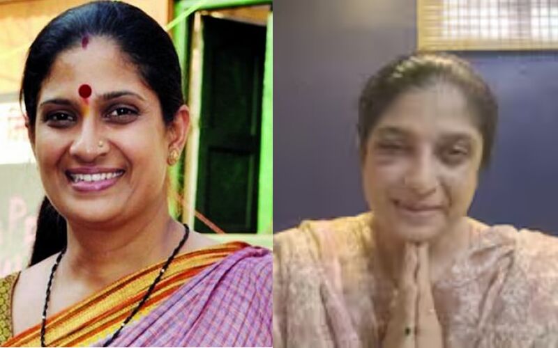 Marathi Actress Chinmayee Sumeet Injured In Road Accident; Video Shows Swollen Eyes, Facial Bruises- Later Deleted From Social Media