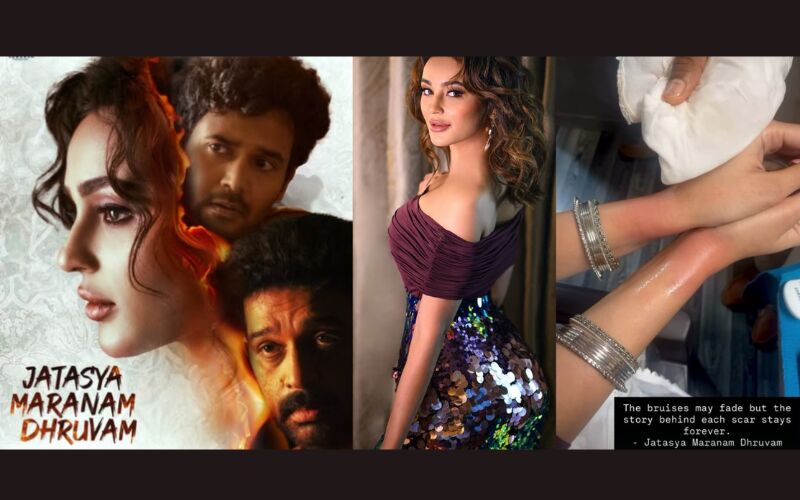 Seerat Kapoor Shares Behind-the-Scenes Injury Ahead Of Pan-India Film ‘Jatasya Maranam Dhruvam’: “The Pain Will Be Worth It”