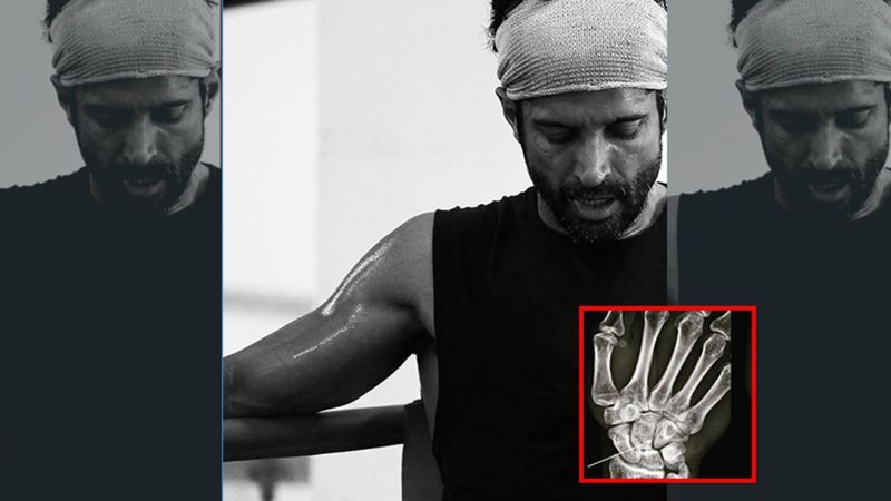 Farhan Akhtar Suffers A Hairline Fracture While Shooting For Toofan; Check Out His X-Ray Report That Looks Like 'Tetris'