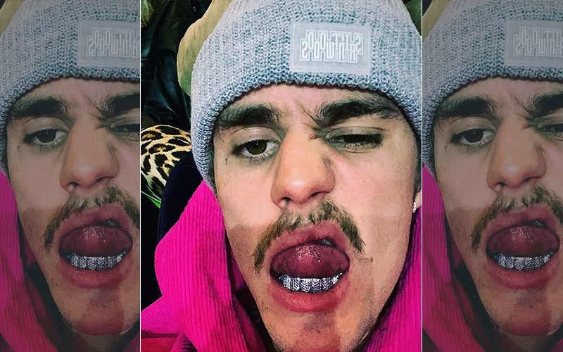 Justin Bieber Flaunts His Blingy Silver Teeth, But Fans Want Him To
