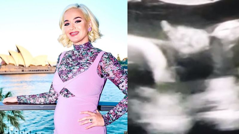 Katy Perry’s Unborn Baby Shows Middle Finger During An Ultrasound; Singer Is Excited, ‘You Know You’re In For It’ – VIDEO
