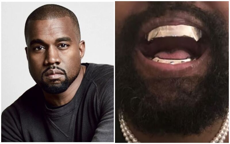 WHAT! Kanye West Replaces His Teeth With James Bond-Style Titanium Dentures Worth A WHOPPING Rs 7 Crore - Read To Know