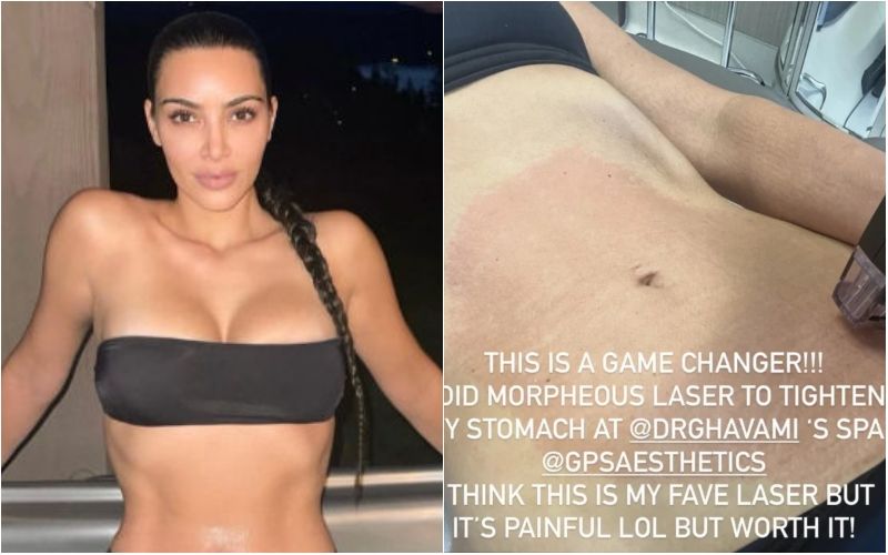 Kim Kardashian Gets Morpheus Laser Procedure For Stomach 'Tightening', Says 'It's PAINFUL But Worth It!'
