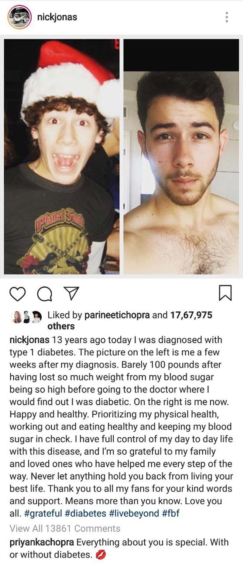 Priyankas Comment On Nick Jonas Instagram Post