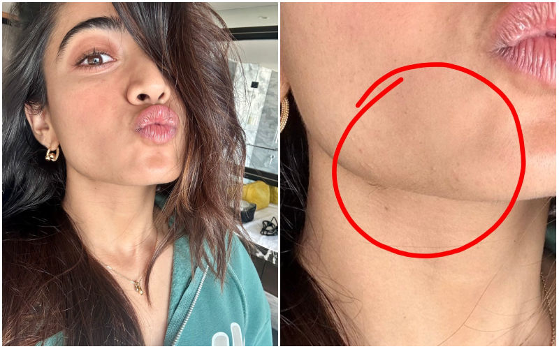 ‘Rashmika Mandana Got Beard And Moustache’ Say Netizens As They Spot Facial Hair On Her Jaw! Insensitive Trolls Ask Her To ‘Use Veet’!