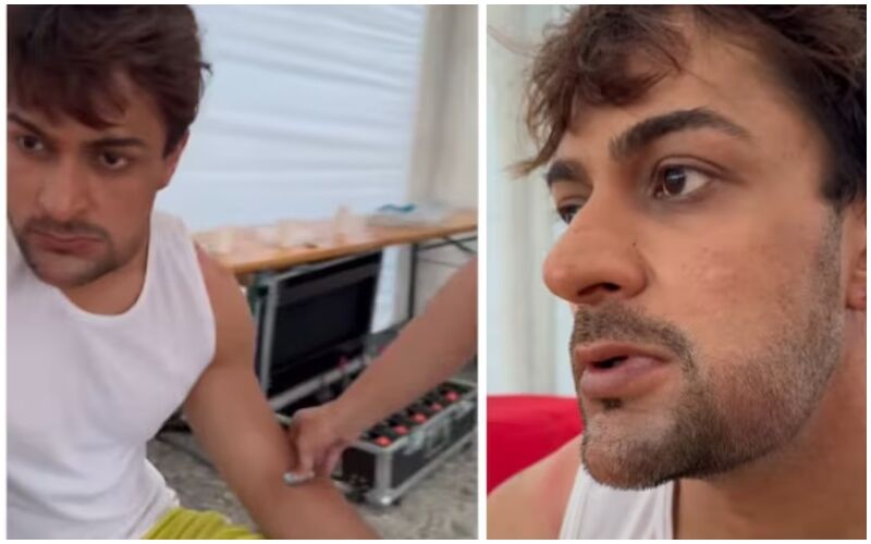 WHAT! Khatron Ke Khiladi 14's Shalin Bhanot Bitten By 200 Scorpions During A Stunt, Actor Shares A VIDEO Of His Swollen Face!