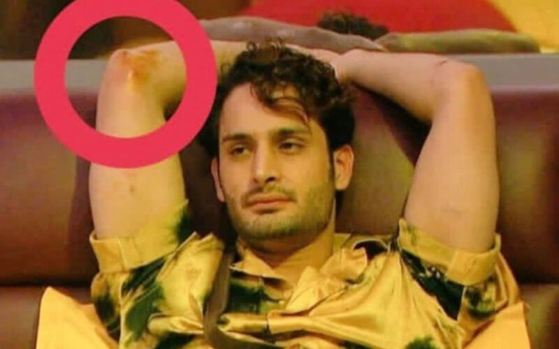 Bigg Boss 15: Umar Riaz Gets Injured During A Task, His PIC Of Bruised Elbow Goes Viral On Internet; Fans Trend ‘Task Slayer Umar’