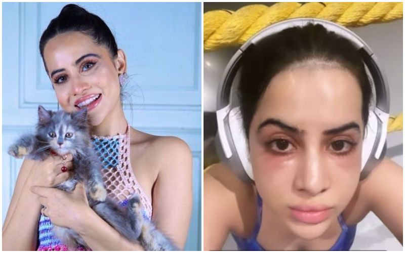 Uorfi Javed Gets Under Eye-Fillers After Getting TROLLED; Says ‘Now My Face Looks F*cked Up’-READ BELOW