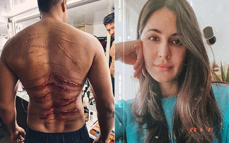 Vicky Kaushal’s Prosthetic Scars From Sardar Udham Have The Netizens Intrigued; A Fan Jokes ‘Katrina Kaif Ko Dukh Hoga’-See PHOTO