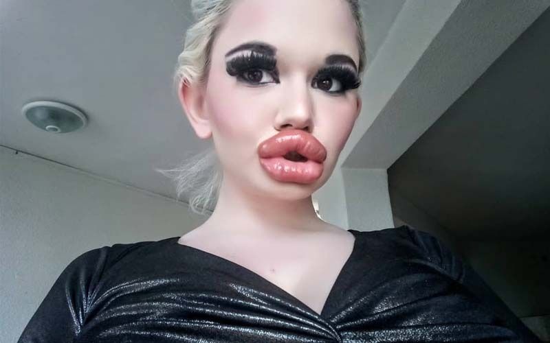Andrea Ivanoa AKA Real Life Barbie Desires To Have The Biggest Lips; Has Already Had Lip Fillers Injected 20 Times