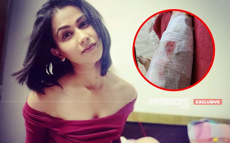Mujhse Shaadi Karoge Winner Aanchal Khurana Meets With An Accident, A Day Before Her Birthday-EXCLUSIVE