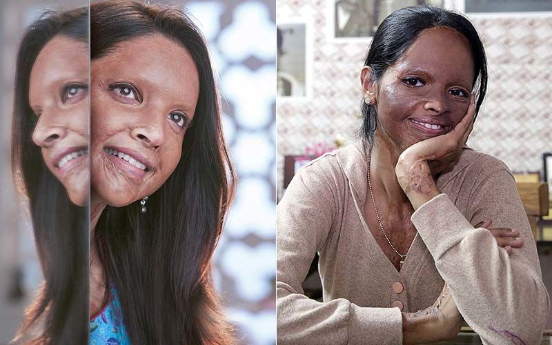 Acid Attack Survivor Laxmi Agarwal On Deepika Padukone's Emotional Moment On Chhapaak Sets, "It Is Natural For Anyone To Break Down"