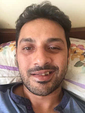 apurva asrani is suffers from bells palsy