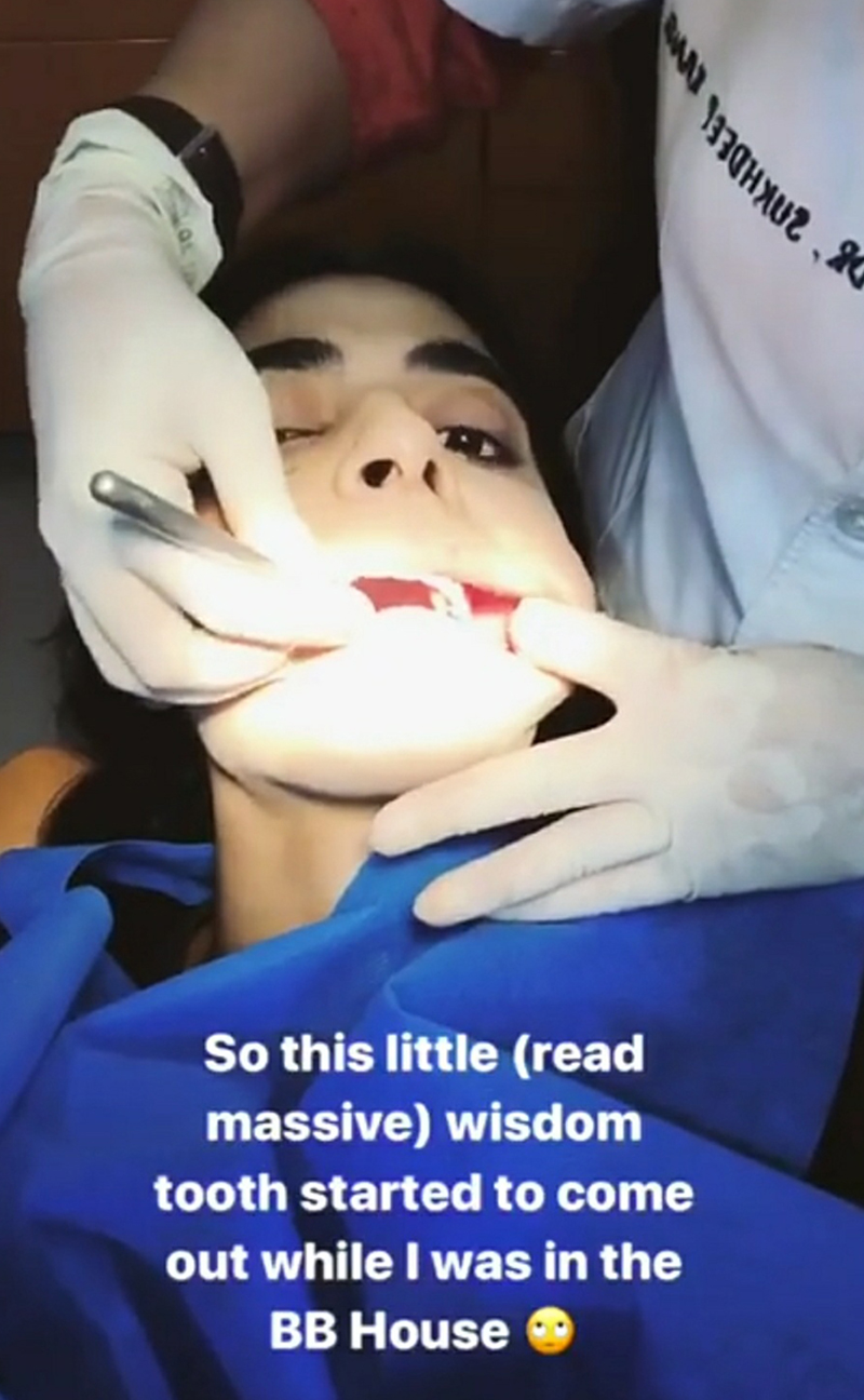 bani j at her dental session