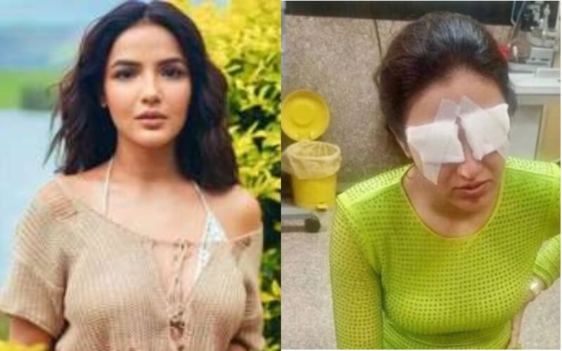 SHOCKING! Jasmine Bhasin Faces Corneal Damage; Dos And Don’t To Follow While Wearing Contact Lens – Read To Know BELOW