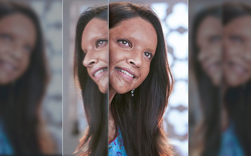 Chhapaak Trailer: Deepika Padukone's Face Might Be Burnt But Her Spirit Is LIT; This Is Standing Ovation Material