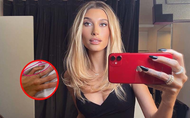 Hailey Baldwin's Crooked Pinky Finger: Lady Begs Fans To ‘Stop Roasting' Her Over Her 'Weird' Fingers