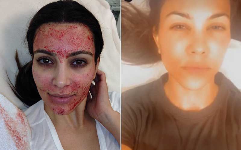While Kim Kardashian Fights A Legal Battle With Vampire Facial Her Sister Kourtney Kardashian Enjoys A Blood Facial