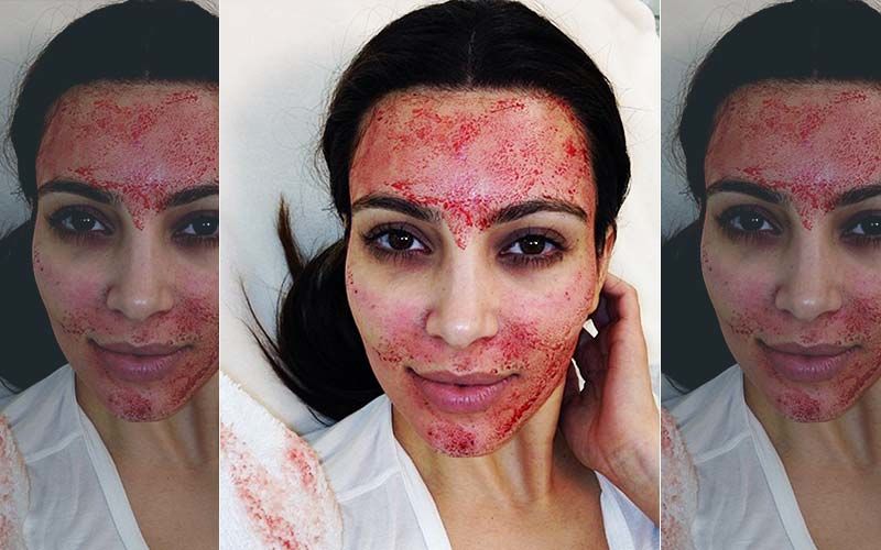 Kim Kardashian Reaches Settlement In Lawsuit Against ‘Vampire Facial’ Doctor