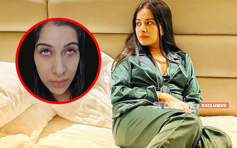 Bigg Boss 14: EXCLUSIVE Pics Of Sara Gurpal's Injured Eyes; Actress Hurt By Nikki Tamboli's Acrylic Nails