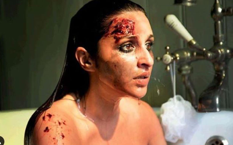 Parineeti Chopra’s Look From The Girl On The Train Revealed! Her Shocked Bruised Face Will Send Chills Down Your Spine