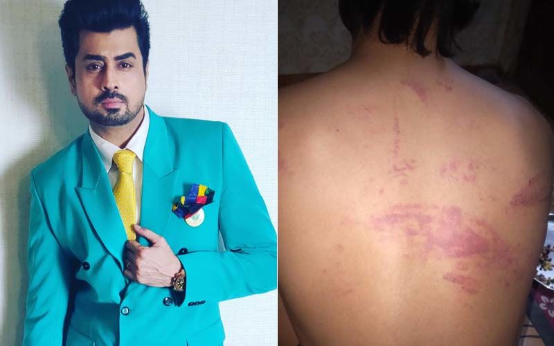 Bigg Boss 8’s Pritam Singh Brutally Beaten Up By Goons For Rescuing A Couple; Shares Disturbing Images Of Injuries