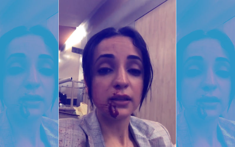 Video: Sanaya Irani Bleeds From Nose, Blames Her Director