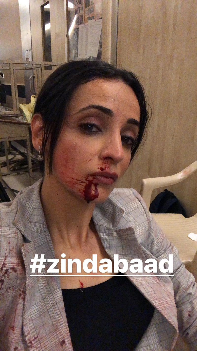 sanaya irani while shooting for zindabad