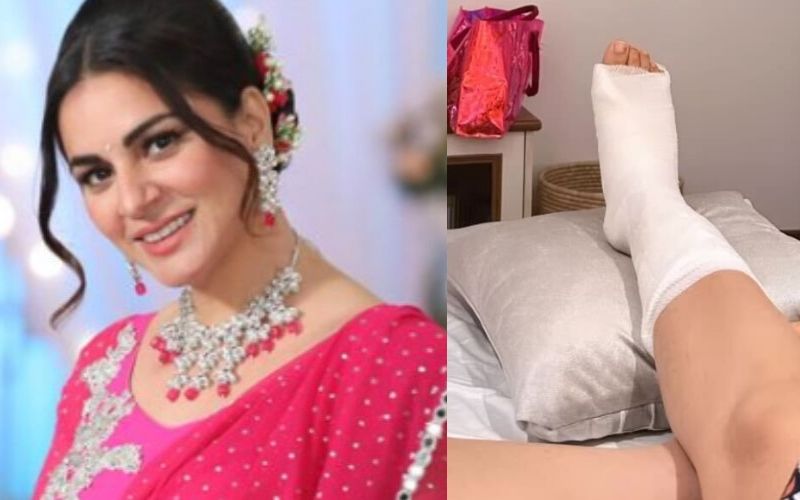 Shraddha Arya Gets INJURED, Shares A Glimpse Of Her Leg In A Cast; Says, ‘I Like To Do My Own Stunts’- Take A Look