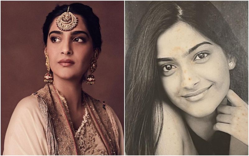THROWBACK! When Sonam Kapoor Recalled Being Body-Shamed By Older Relatives; Said, ‘I Had Body Hair, Acne, My Skin Colour Was A Bit Darker’