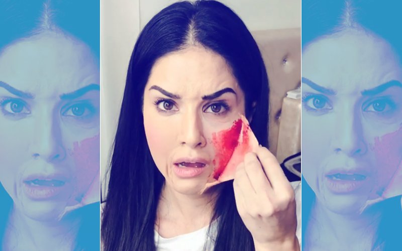 Sunny Leone PEELS OFF Her Skin, Twitteratis Call Her Crazy