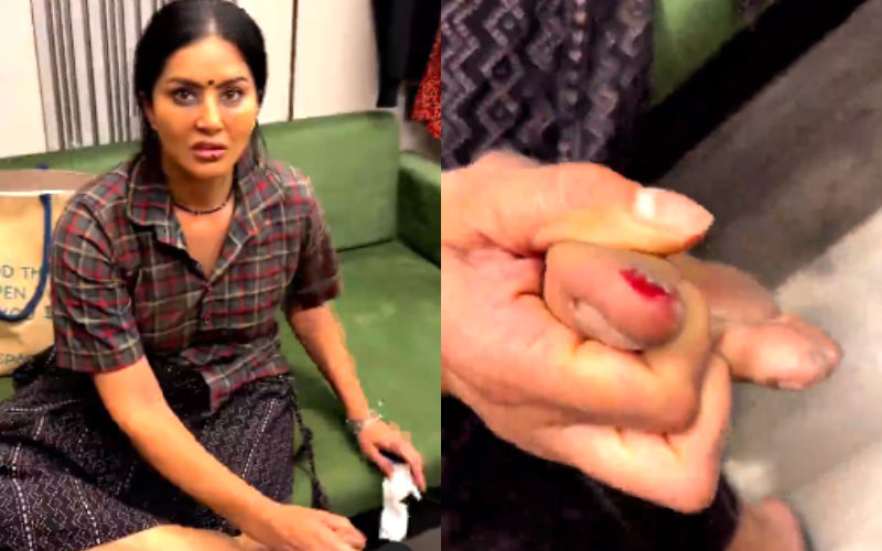 Sunny Leone Gets INJURED On A Movie Set; Shares A Video Of Her Bleeding Toe; Fans Wish The Actress Speedy Recovery