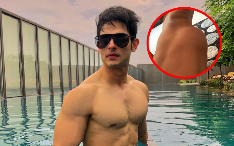 Priyank Sharma Detected With Extra Bone In Thigh, Heads For An Immediate Surgery
