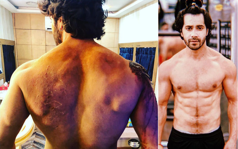 Varun Dhawan Shows Off His Battle Scars From Kalank - View Pic