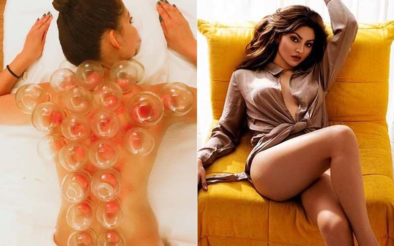 When Urvashi Rautela Underwent ‘Extremely Painful’ Cupping Therapy; Pic Of Her Bare Back Left Fans Concerned