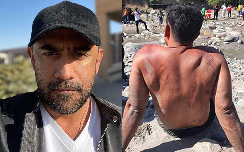 Amit Sadh Suffers Serious Back Bruises During Rigorous Training For Zidd; Angry Red Marks On His Back Look Disturbing