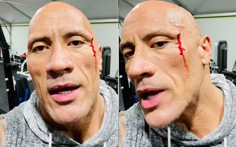 Dwayne Johnson Aka The Rock Gets Badly Hurt During A Rigorous Workout Session; Says He ‘Needs Stitches' As He Shares Bleeding Video-WATCH
