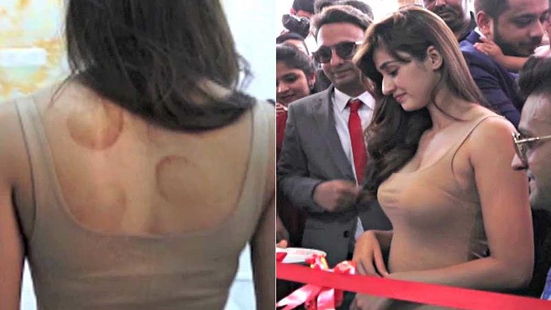 When Disha Patani's Bare Back Cupping Marks Grabbed Attention At An Event- VIDEO