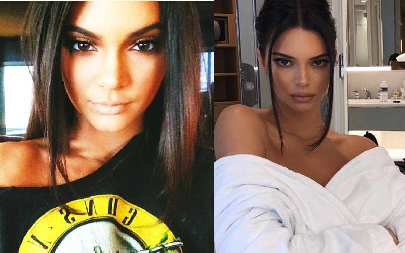 Kendall Jenner's Unrecognisable Before And After Pictures That Suggest Her SHOCKING Transformation Post Plastic Surgery