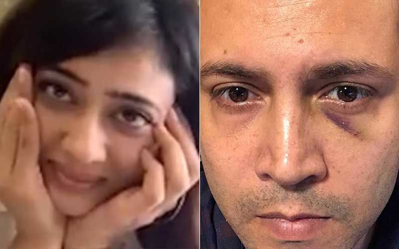 After Sharing Shweta Tiwari's Picture, Estranged Husband Abhinav Kohli Posts Pic Of His Swollen Eye; Warns Followers, 'Don't Get Abusive'