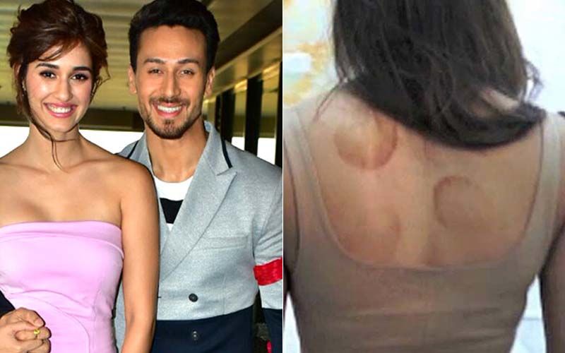 Tiger Shroff Sports Cupping Marks On His Back As He’s  Spotted Post Dubbing Session; Disha Patani Once Grabbed Attention With Her Cupping Marks Too
